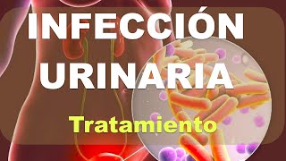 Mejores Antibióticos para Tratar una Infección Urinaria [upl. by Aramoj508]