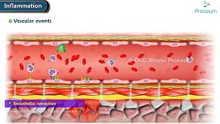 2 Acute Inflammation Vascular Events Animation [upl. by Binny]