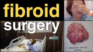 FIBROID SURGERY  ABDOMINAL MYOMECTOMY  PRE  POST OP amp RECOVERY  BEHIND THE SCENES VLOG  Part 1 [upl. by Capwell874]