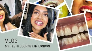 Teeth Transformation  Vithya Hair and Makeup [upl. by Piwowar720]