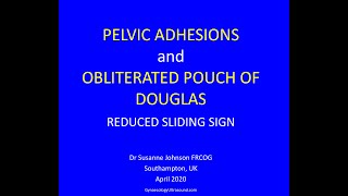 PELVIC ADHESIONS AND FROZEN PELVIS [upl. by Nylrem]