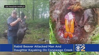 Rabid Beaver Attacks Man Daughter During Kayak Trip [upl. by Nawram]