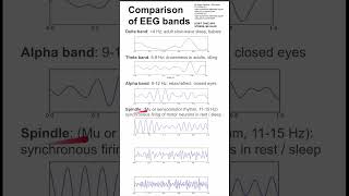 Comparison of electroencephalography EEG bands [upl. by Kevin844]