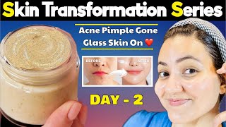 Glass Skin Transformation Series Day 2  Get Clear Healthy Glowing Spotless Glass Skin in 5 Days💕 [upl. by Kieryt]