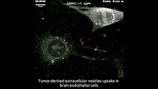 Tumorderived extracellular vesicles uptake in mouse brain endothelial cells [upl. by Eener]