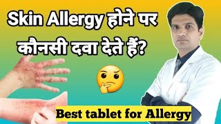 Tablets for allergy  Skin Allergy होने पर कौनसी दवा ली जाती है  Cetirizine hydrochloride tablets [upl. by Ecidnac]