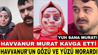 SEDA SAYAN HAVVANUR MURAT KAVGA ETTİ MURAT TOKAT ATTI GÖZÜ MORARDI YAYINLANMAYAN GÖRÜNTÜLER [upl. by Anillek742]