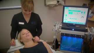 San Diego HydraFacial MD Demonstration [upl. by Airal]