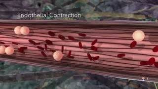 Acute Inflammation Educational 3D Animation [upl. by Alletneuq685]