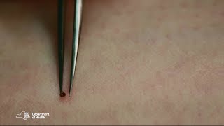 Proper Tick Removal [upl. by Larina]