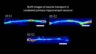 VideoOfTheDay Timelapse imaging and measurement of mass transport in neurites [upl. by Malachi]