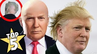 TOP 5  DONALD TRUMPS BALD SPOT SHOCKING FACTS [upl. by Adleme274]