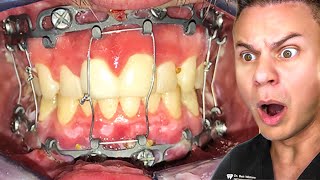 TikToks That Will Make You Want Braces [upl. by Ladd]