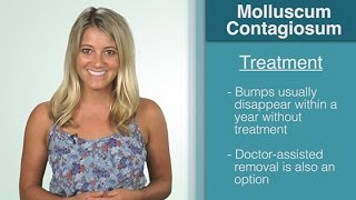 What Is  Molluscum Contagiosum [upl. by Lexa]