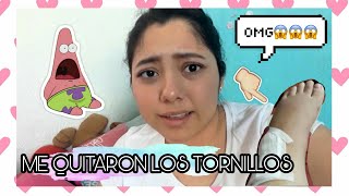 ME SACAN LOS TORNILLOS DEL TOBILLO  VLOG  AndySa [upl. by Bonita]