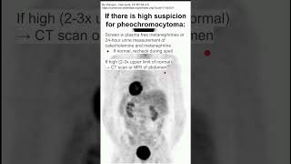 If there is high suspicion for pheochromocytoma [upl. by Deevan530]