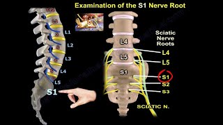 Examination Of S1 Nerve Root  Everything You Need To Know  Dr Nabil Ebraheim [upl. by Thurmann]