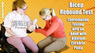 Biceps Rebound Test Coordination Testing with an Adult with Athetoid Cerebral Palsy 10 [upl. by Phippen]