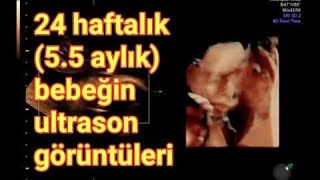 24 gebelik haftası 55 aylık gebelik bebeğin 4d ultrasonografi görüntüleri [upl. by Anihtyc]