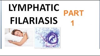 Parasitology 221 a Wuchereria Bancrofti Filariasis Filarial worm Elephantiasis Culex Microfilaria [upl. by Silva]