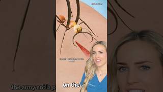 Doctor reacts ant stitches zackdfilms [upl. by Kristi640]