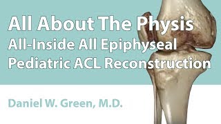 AllInside All Epiphyseal Pediatric ACL Reconstruction [upl. by Mellette]