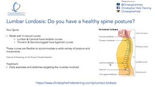 Lumbar lordosis Do you have a healthy spinal posture [upl. by Dnomaid]