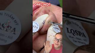 Horror BLACKHEAD REMOVAL  Worst Blackhead Removal 2024 shorts [upl. by Monti]