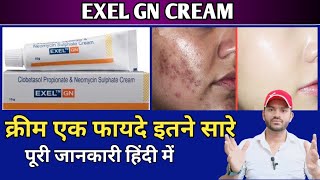 Exel gn cream use dose benefits and Side effects full review in hindi [upl. by Oderfigis48]