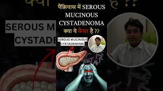 serous mucinous cystadenoma pancreas  serous mucinous cystadenoma is cancer  Pancreatic lesions [upl. by Yarased426]