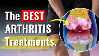 Knee Arthritis Treatments Proven to Work  The Truth You Need to Know [upl. by Suzzy]