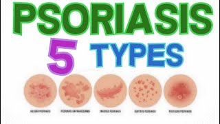 THE 5 MAIN TYPES OF PSORIASIS  PSORIASIS CLASSIFICATION [upl. by Eugenius357]