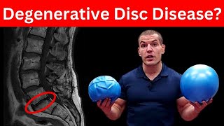 4 MustDo Exercises For Degenerative Discs In Lower Back Dont Skip These [upl. by Wilkens]