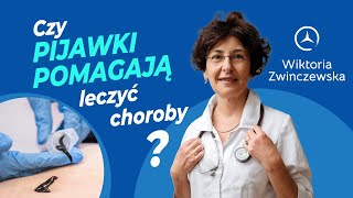 Czy pijawki pomagają leczyć choroby [upl. by Salli782]