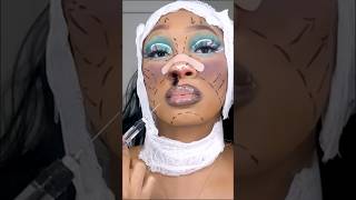 Botched Plastic Surgery Makeup Tutorial 💉 [upl. by Garceau]