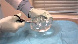 The Inside of a Silicone Breast Implant  David Reath Knoxville Plastic Surgeon [upl. by Retsel600]