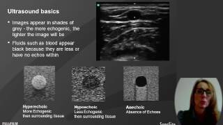 Webinar Ultrasound in Hemodialysis Assessment amp USGuided Cannulation for Dialysis Nurses [upl. by Solakcin557]