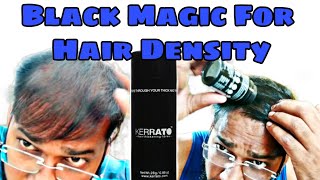 Best Hair Building Fiber KERRATO HAIR FIBER  How to Increase Hair Density After Hair Transplant [upl. by Rab]