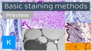 Basic histological staining methods preview  Human Histology  Kenhub [upl. by Caty961]