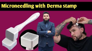 microneedling derma stamp derma roller hair regrowth  hair loss treatment  how to use derma Roler [upl. by Kenneth428]