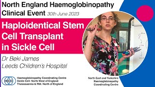 Haplo Stem Cell Transplants in Sickle Cell N England Haemoglobinopathy Clinical Event 300623 [upl. by Esiuol887]