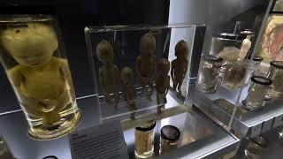 The Hunterian Medical Museum London UK [upl. by Audry703]