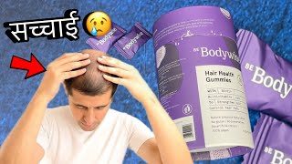 Bodywise hair gummies  Sad 🥲 Reality  Honest Review  Hindi [upl. by Clift]