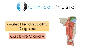 Classic Gluteal Tendinopathy Diagnosis  Clinical Physio [upl. by Nosreffej949]