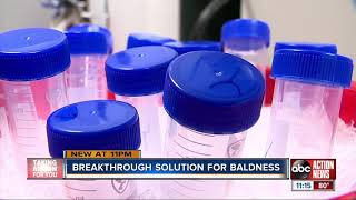 California lab creating cure for baldness using cell cloning process [upl. by Felipa44]