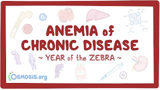 Anemia of chronic disease Year of the Zebra [upl. by Sapphera]