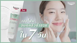 ใหม่ เจลโฟมจบทุกสิวซ้ำซากใน 7 วัน EUCERIN 3X TREATMENT GEL TO FOAM CLEANSER [upl. by Isdnil622]