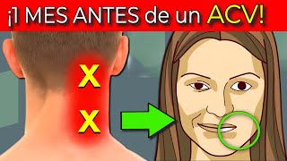 7 SEÑALES de ADVERTENCIA 1 MES ANTES DE UN ACV ICTUS CEREBRAL [upl. by Ahsehat]