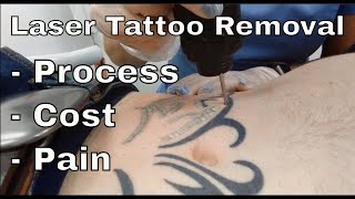 Laser Tattoo Removal  Neck Tattoo after 7 sessions [upl. by Kinsley505]