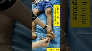 babinski with triple flexion response shorts medical aiims viral trending youtubeshorts [upl. by Wager482]